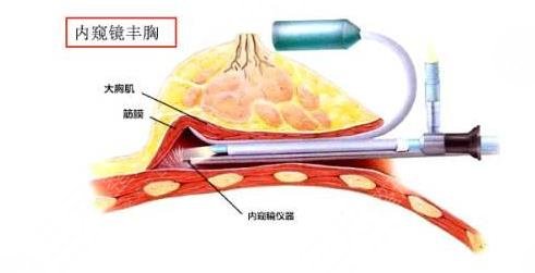 王義山整形好嗎