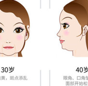 丹東第(一)醫(yī)院臉部面b提升有副作用嗎