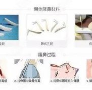 上海鼻整形哪個(gè)醫(yī)生好