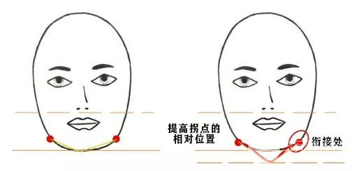 面部填充OR收緊