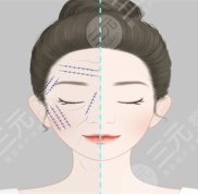 2024四川華美紫馨整形價格表(價目表)震撼來襲