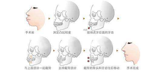 王剑宁正颌怎么样