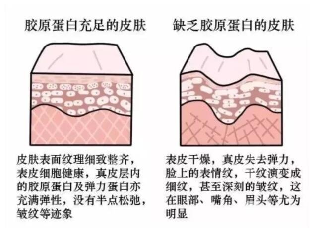 膠原蛋白面部填充能管多久