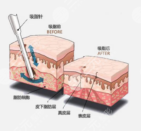 南京華美整形醫(yī)院哪個(gè)醫(yī)生比較好