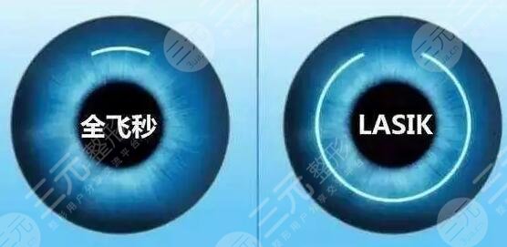 上海做近视眼手术的医院哪家好