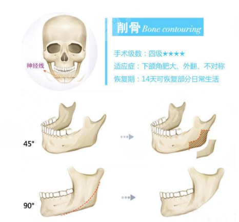 八大处尹琳磨骨怎么样