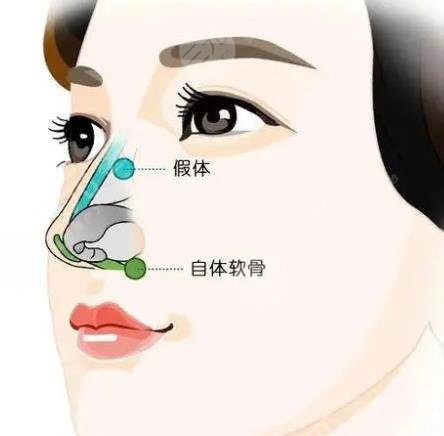 2022上海鼻修复哪个医生好
