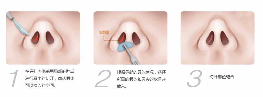 襄阳伯蒂整形医院怎么样