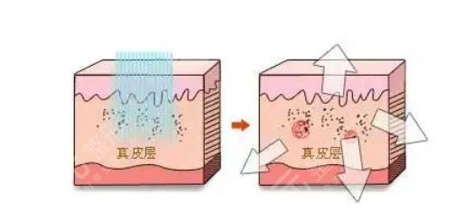 廣東省皮膚病醫(yī)院美容科劉小筠醫(yī)生怎么樣