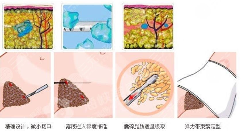 四川華西醫(yī)院整形科怎么樣