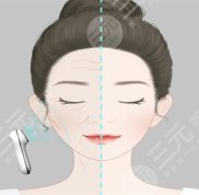 寧波割雙眼皮哪家整形醫(yī)院好
