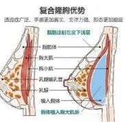 昆明乳房整形醫(yī)生