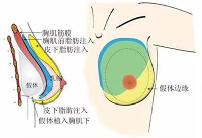 李勁良口碑好嗎