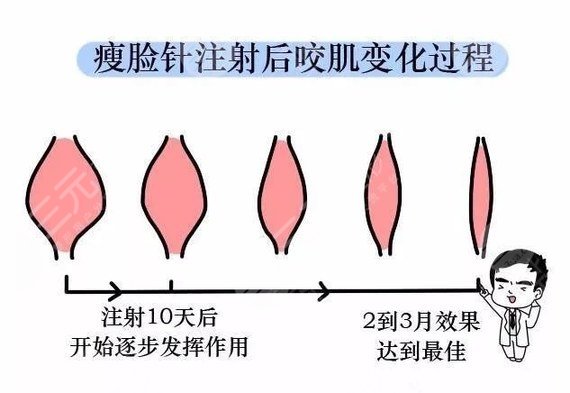 貴州赤水人民醫(yī)院注射瘦臉怎么樣