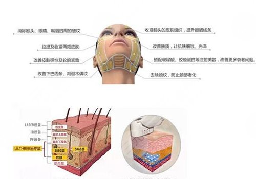 面部抗衰tips