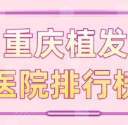 重慶植發(fā)醫(yī)院排行榜