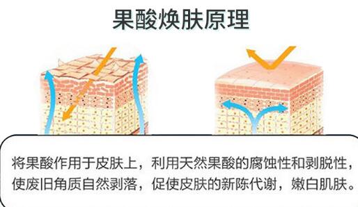 果酸、水楊酸、牛奶酸……會敏感