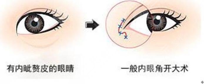 上海10大双眼皮医生名单