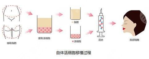 排名前十的整形醫(yī)院有哪些