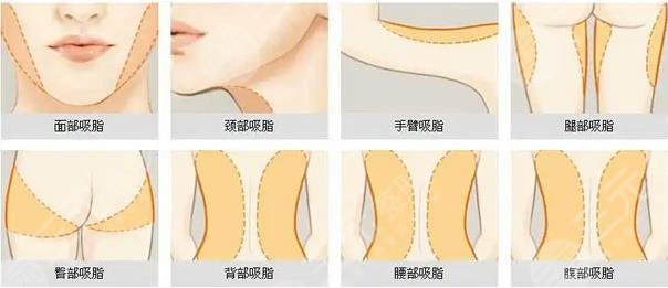 深圳美萊郭杰怎么樣