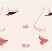 武漢天佑醫(yī)院整形科李蕓醫(yī)生簡介