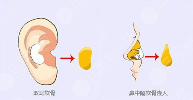 巴彦淖尔小白楼整形正规吗