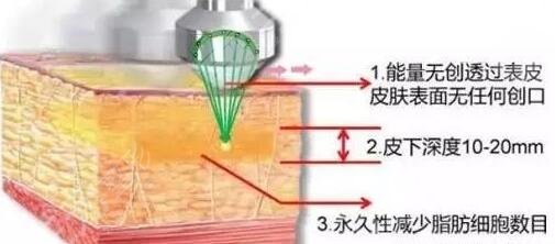 做超脂塑對(duì)身體有害嗎