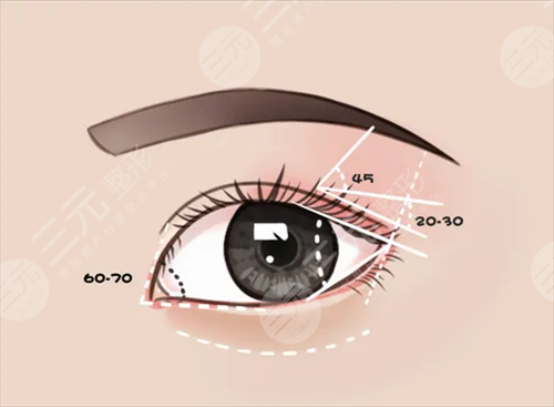 广州双眼皮修复专家排名
