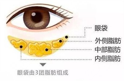 上海九院徐庆做眼袋手术怎么样