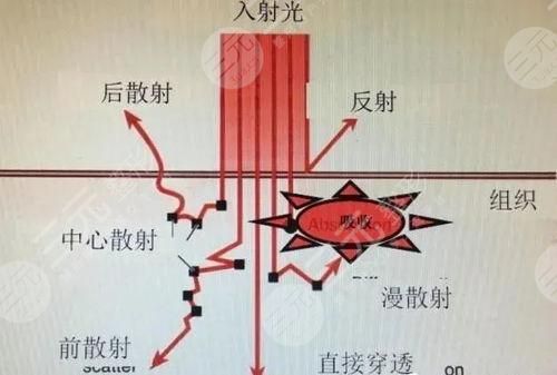 協(xié)和鐘愛梅案例來襲