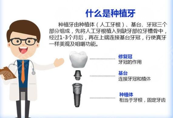 2022北京十大种植牙私立牙科排名更新