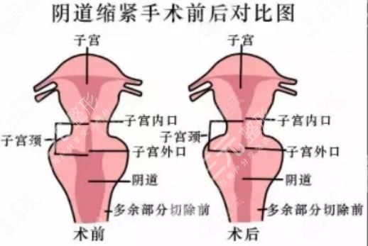 廣州齊云香私密整形怎么樣