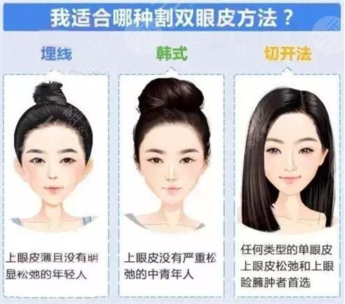 上海双眼皮修复专家排行红榜