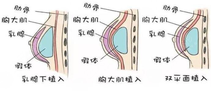 中國(guó)隆胸醫(yī)生排名