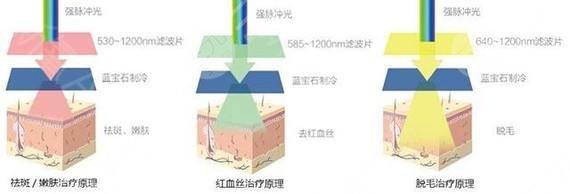 湘雅附二跟中南大學(xué)湘雅醫(yī)院哪個皮膚科好