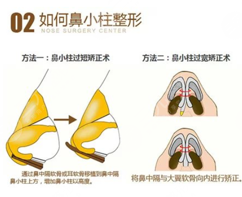 陳飛春做鼻子怎么樣