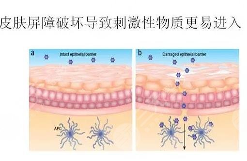 维纳斯抗衰仪多少钱一次