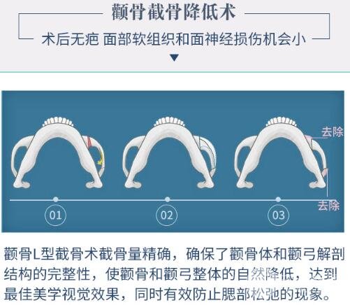 上海九院整形科专家韦敏简介