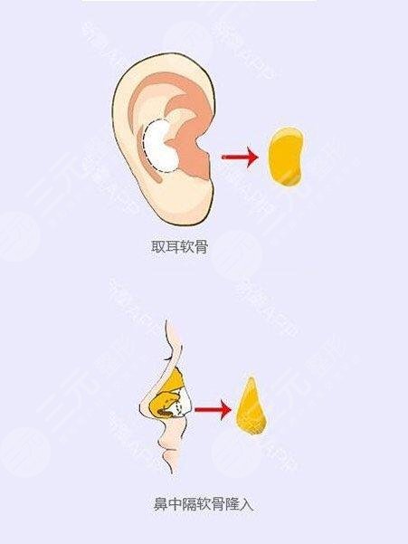 上海鼻整形专家医生排名新发布