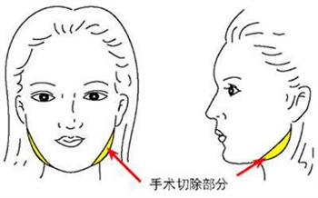 張詩雷坐診時間公布