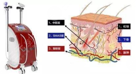 上海九院董继英热拉提果怎么样