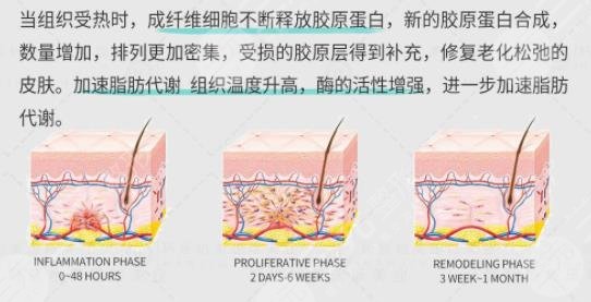 成都铜雀台7d聚拉提怎么样