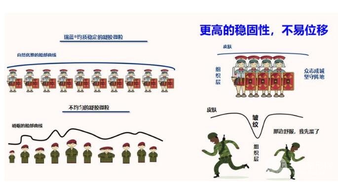 玻尿酸的“华山论剑”—瑞蓝3号丽瑅PK乔雅登较好