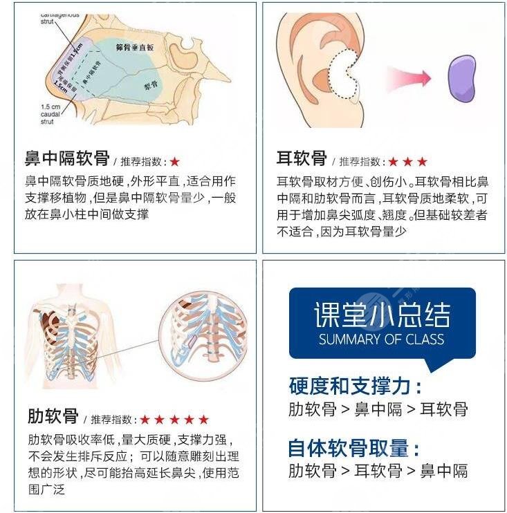 上海李鸿君医生案例鼻子整形果