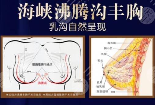 林沸騰手術(shù)價(jià)格分享