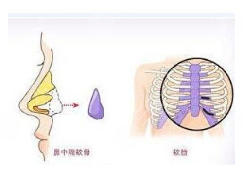 鄭州天后王永功做鼻子怎么樣