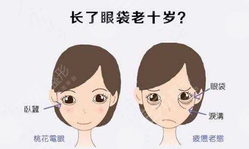 胡金香雙眼皮修復怎么樣