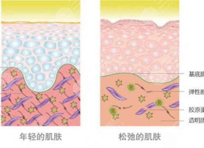 賽諾秀5d膠原光和熱瑪吉區(qū)別抗衰必看