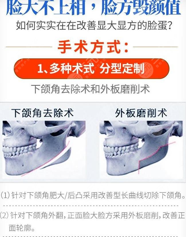 北京下颌角磨骨医生排名2022