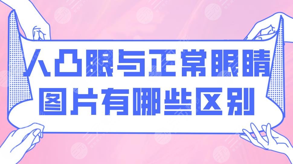 人凸眼與正常眼睛圖片有哪些區(qū)別